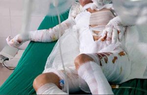 En Argentina: mujer le prende fuego a su marido por infiel